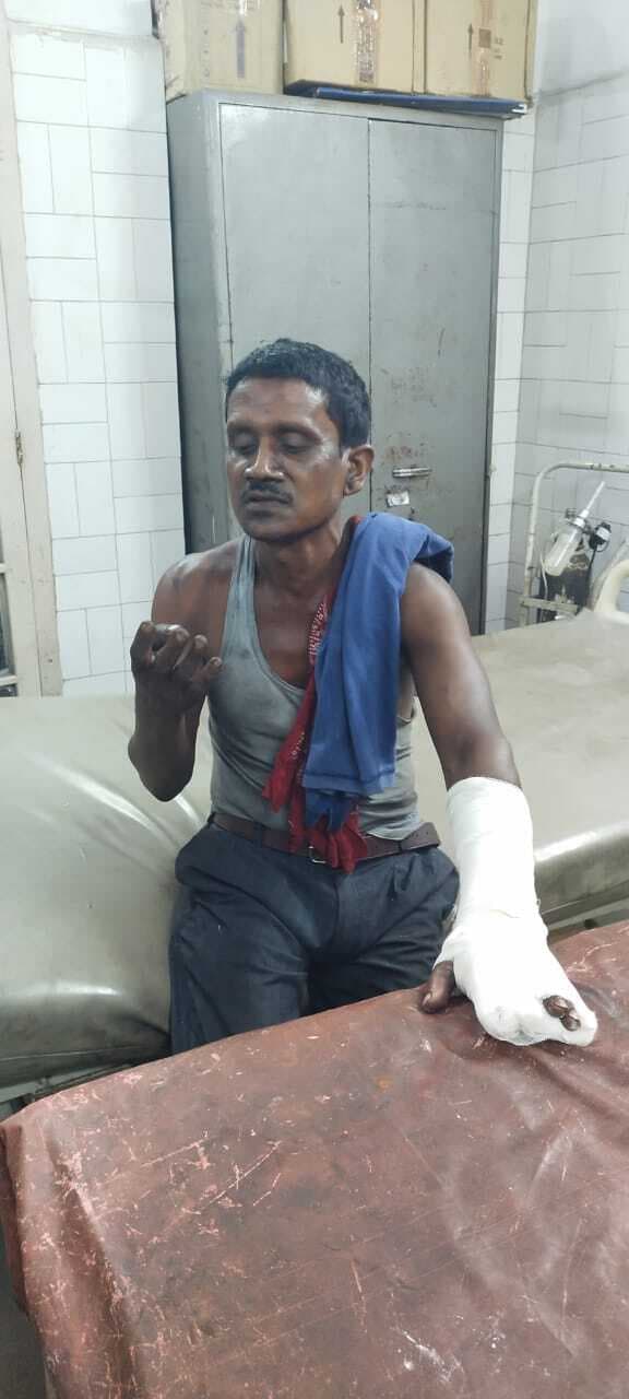 Bokaro News : सीसीएल ढोरी : खदान की चाल धंसने से ओवरमैन समेत चार कर्मी घायल