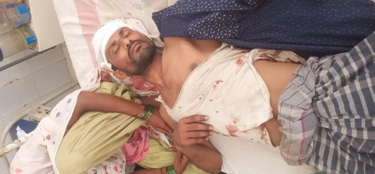 मारपीट के दौरान दंपती घायल