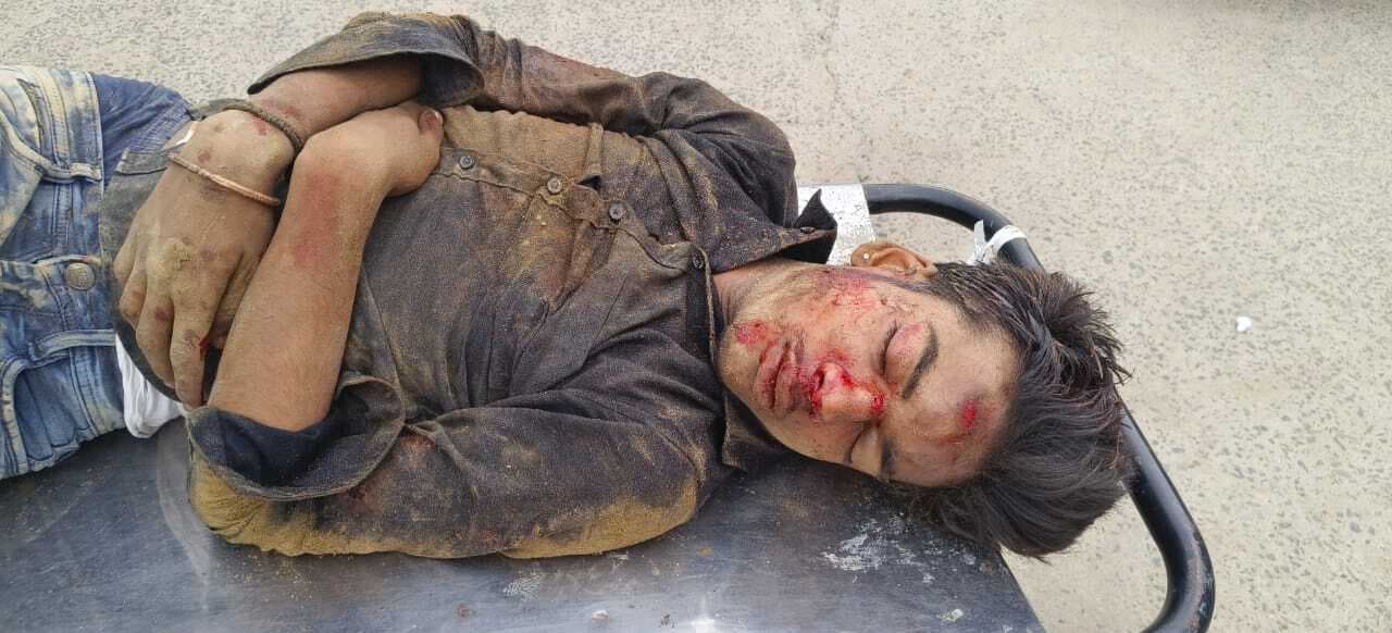 Bhagalpur news यात्री को पत्थर मारकर नदी में गिराया, मोबाइल लेकर भागा