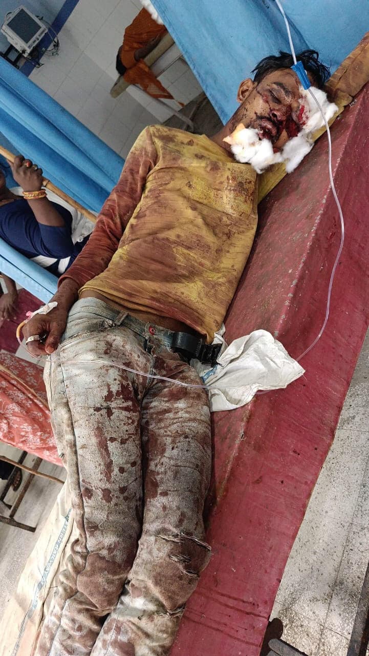 Samastipur : हैदराबाद जा रहा युवक ट्रेन से गिरकर घायल