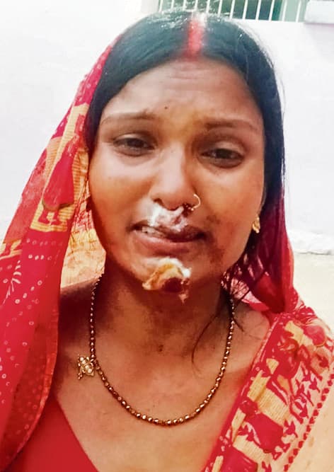 Gaya News : खुजली वाला स्प्रे छिड़क महिला से दो लाख रुपये के साथ आभूषण लूटा