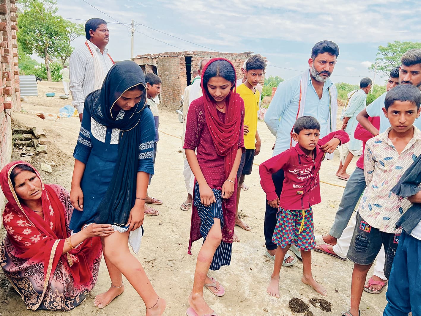 Gopalganj News  : फुलवरिया में पुलिस ने लोगों को पीटा, यूपी के मजदूर की मौत, कई महिलाएं व बच्चे जख्मी