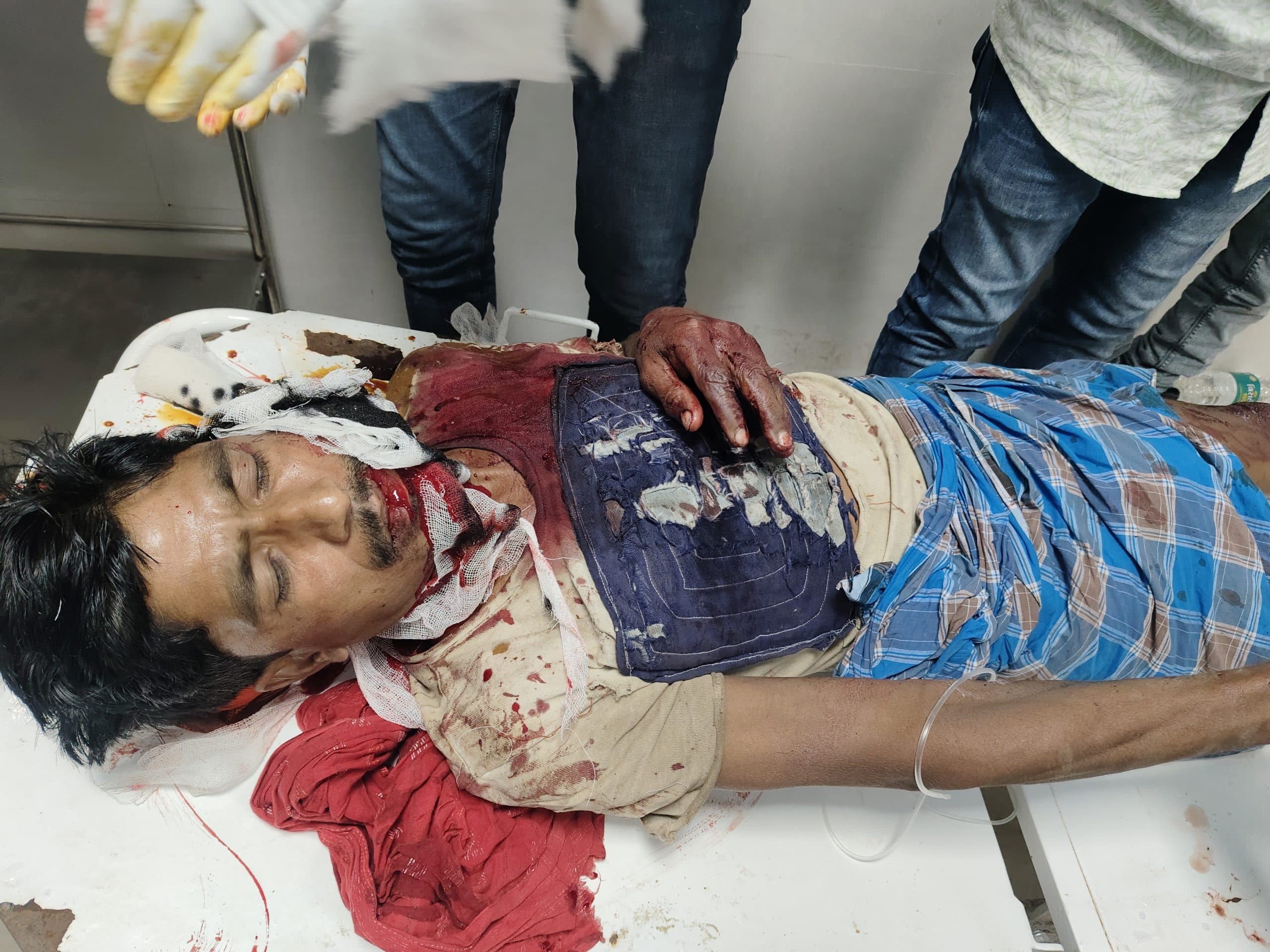 धारदार हथियार के वार से युवक घायल, पटना रेफर