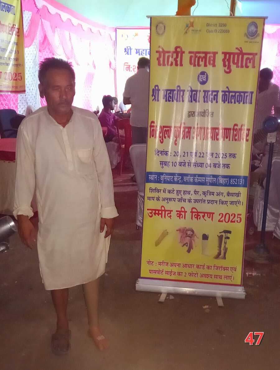 पहले दिन शिविर में 75 दिव्यांगजनों ने कराया निबंधन, दस को मिला कृत्रिम अंग