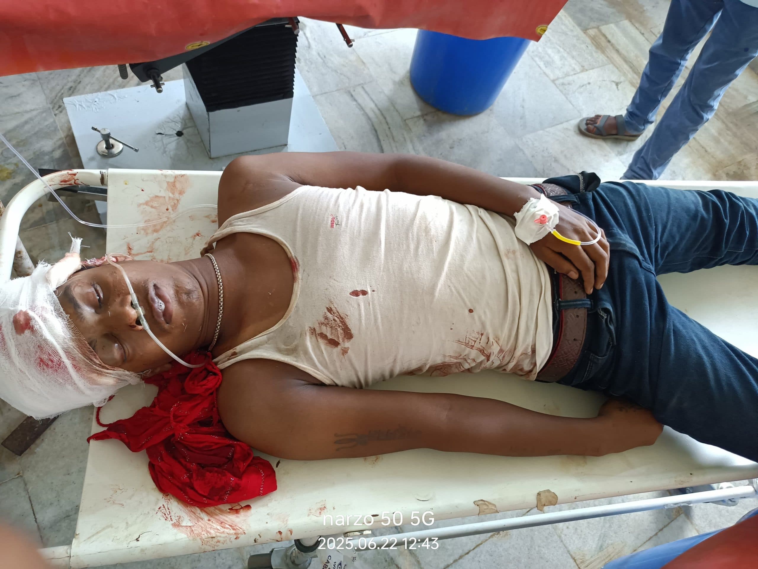 ट्रेन की चपेट में आकर युवक गंभीर रूप से जख्मी