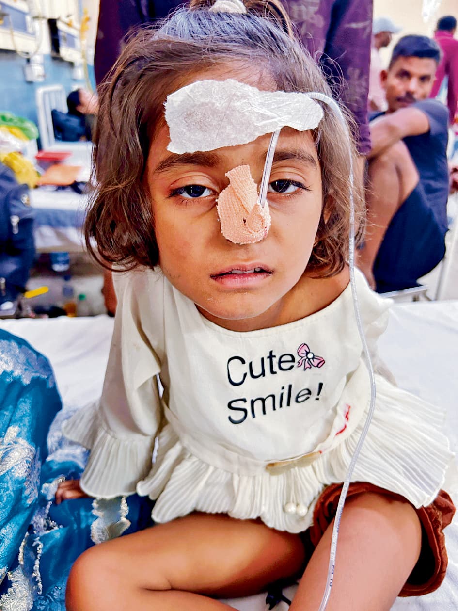 Patna News : खेल-खेल में बच्ची ने निगली चाबी की रिंग, सर्जरी के बाद बची जान