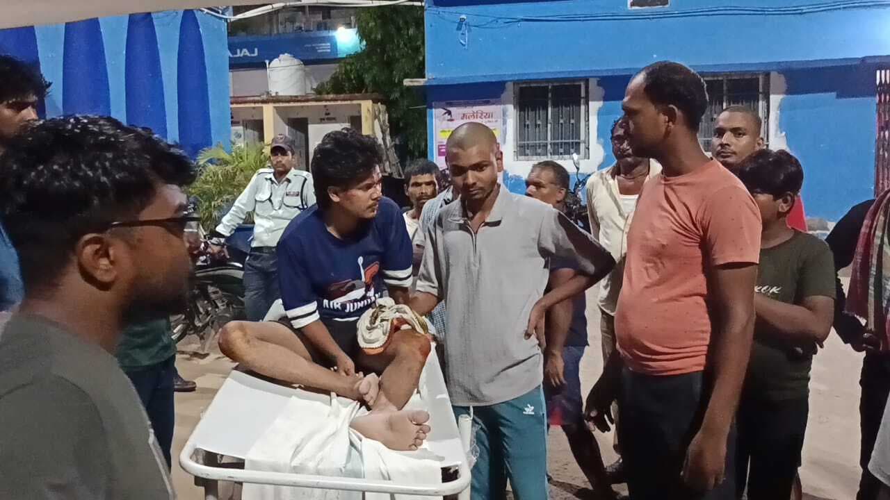 बाइक के धक्के से सड़क किनारे खड़े बालक का टूटा पैर, चालक जख्मी