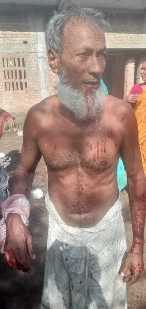 जंगली सियार के काटने से एक दर्जन ज्यादा लोग घायल