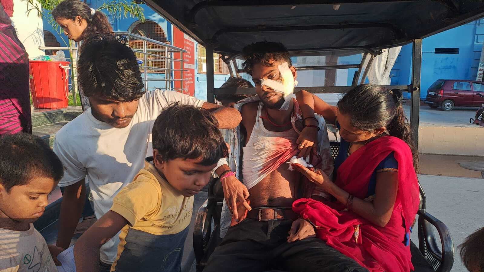 पति ने पत्नी के साथ कंपनी गार्डन में बैठे चचेरे भाई को चाकू मार किया घायल