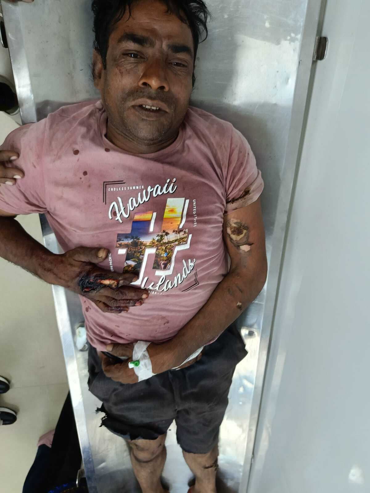 करंट लगने से बिजली विभाग के दो मानव बल हुए घायल