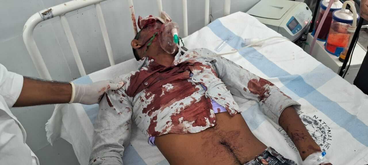 दो बाइकों में टक्कर, तीन घायल, दो की स्थित गंभीर