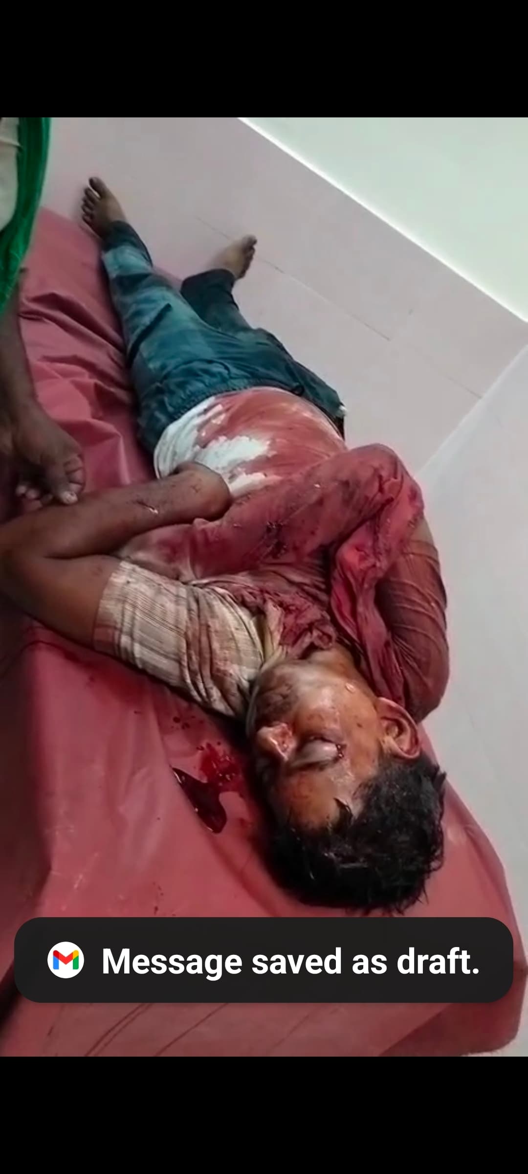 Samastipur News:सड़क दुर्घटना में शेरपुर के पूर्व पंसस गंभीर घायल