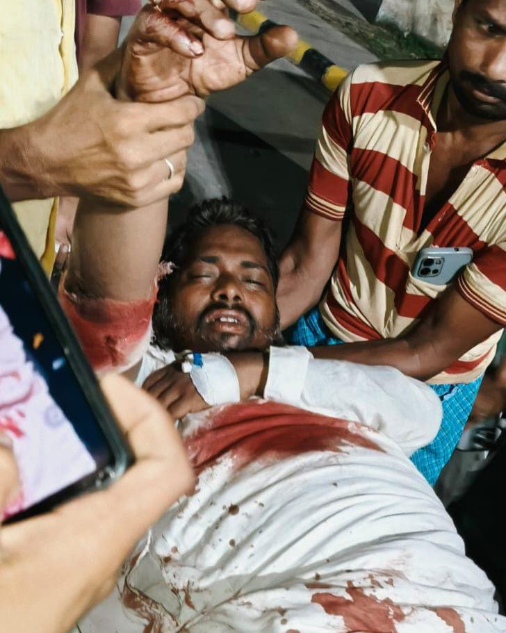 गोलीबारी में घायल ट्रेडर्स मालिक खतरे से बाहर, तीन अज्ञात पर मामला दर्ज