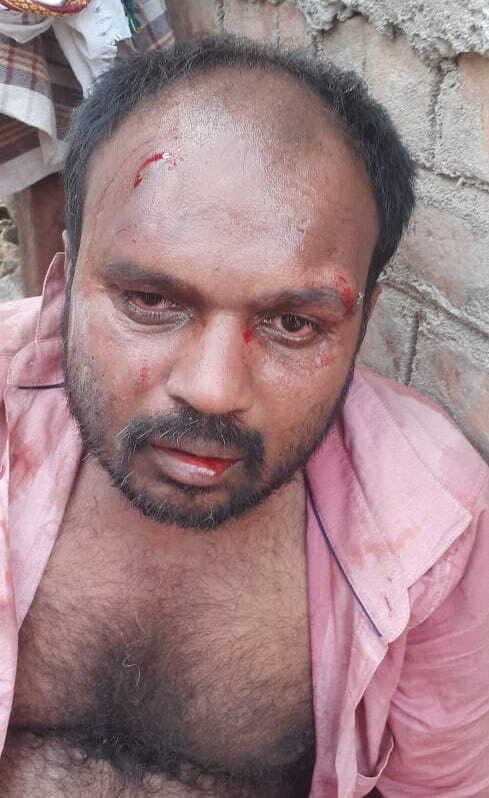 मिठनपुरा में लूटपाट कर भाग रहे एक अपराधी को लोगों ने पीट- पीटकर किया अधमरा, पिस्टल बरामद