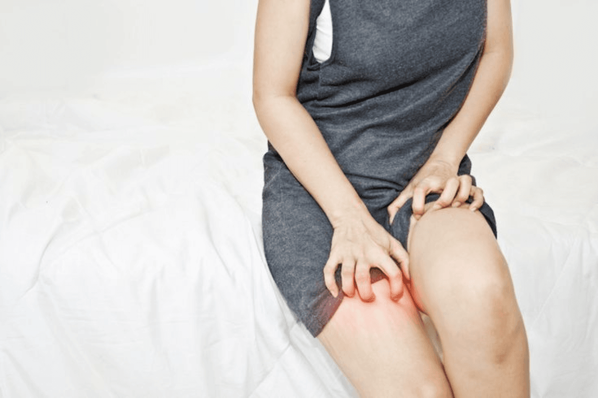 Inner Thigh Rashes