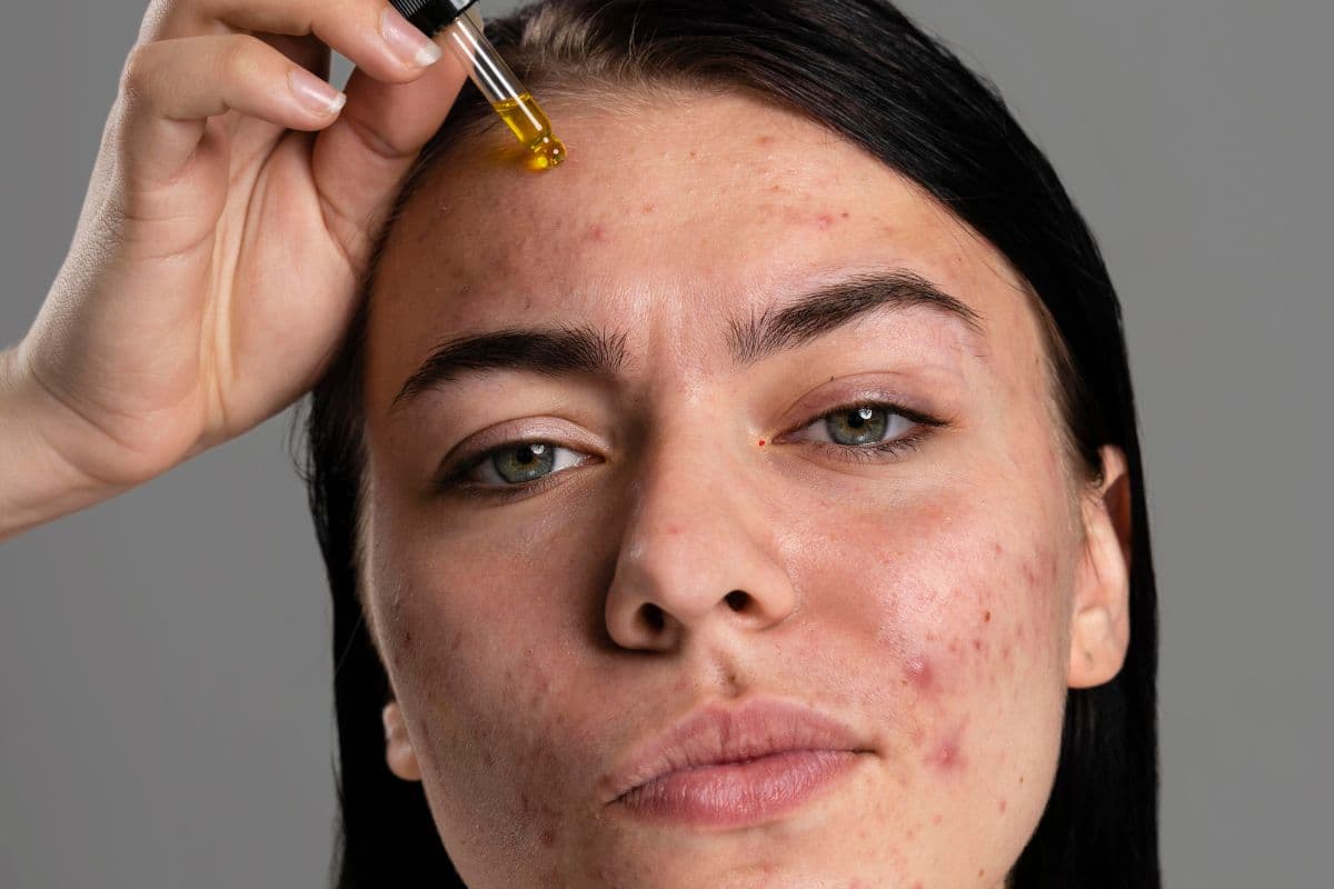 सुबह की ये 5 गलतियां आपके स्किन को करेगी बर्बाद, होम रेमेडीज भी नहीं आएगा काम