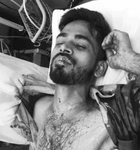 Jamshedpur News : जुगसलाई : प्रेम-प्रसंग में टेंपो चालक पर चाकू से हमला