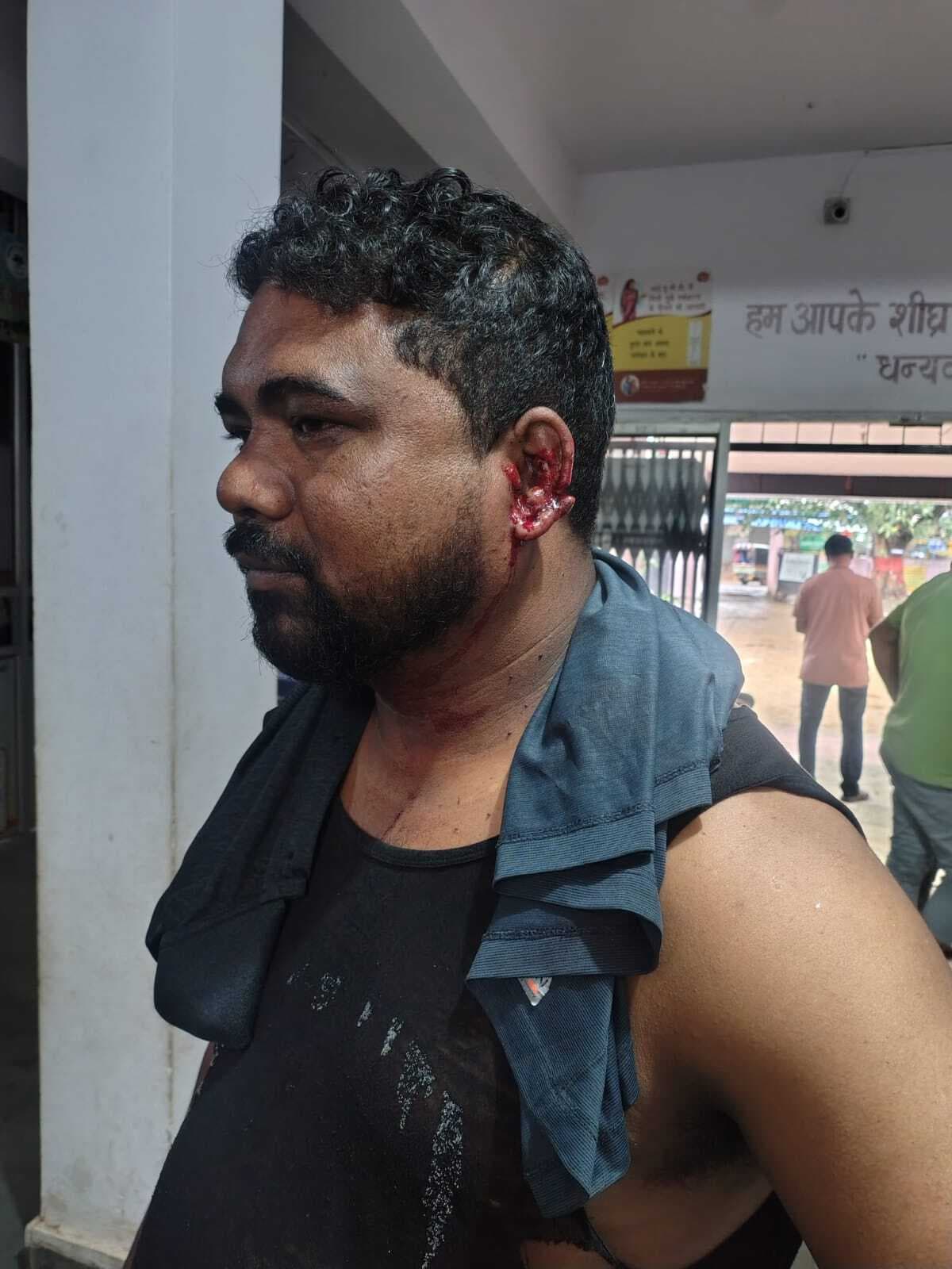 जमीन विवाद में मारपीट, तीन महिला समेत चार घायल