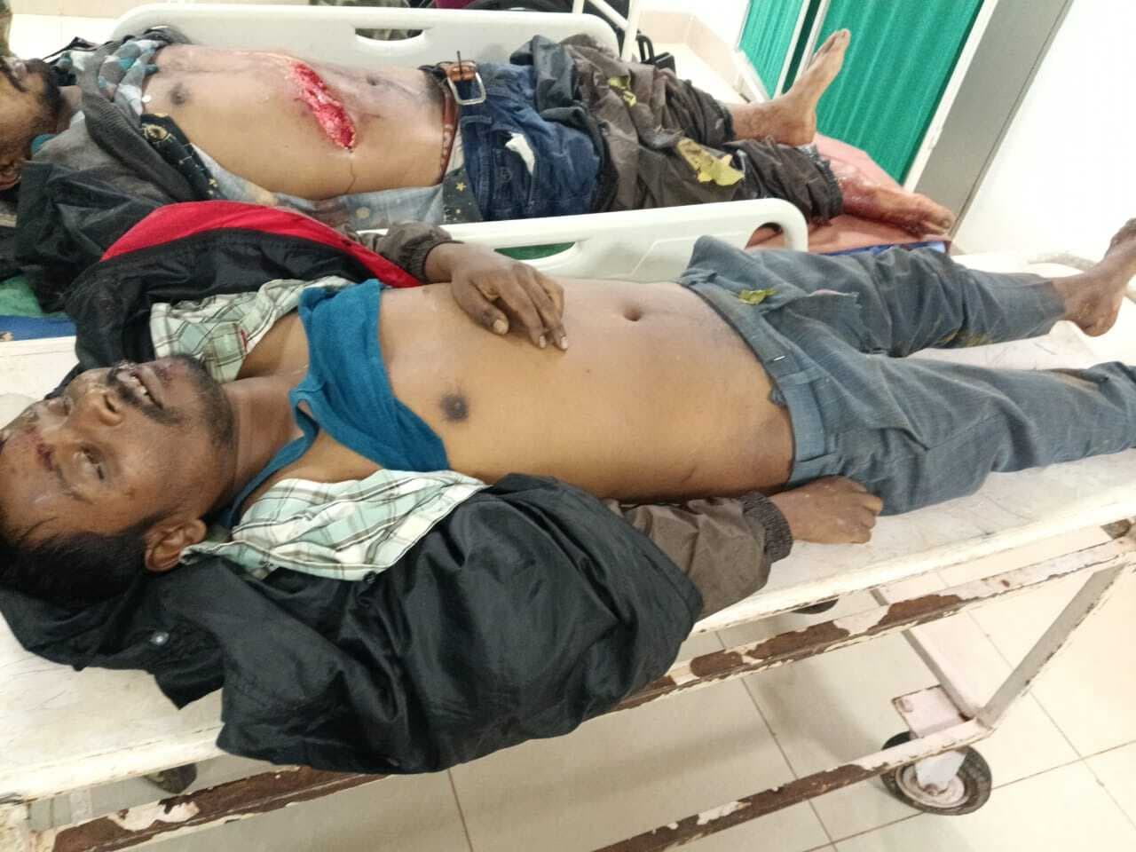 Chaibasa News : पिकअप वैन व बाइक में भिड़ंत, दो युवकों की मौत