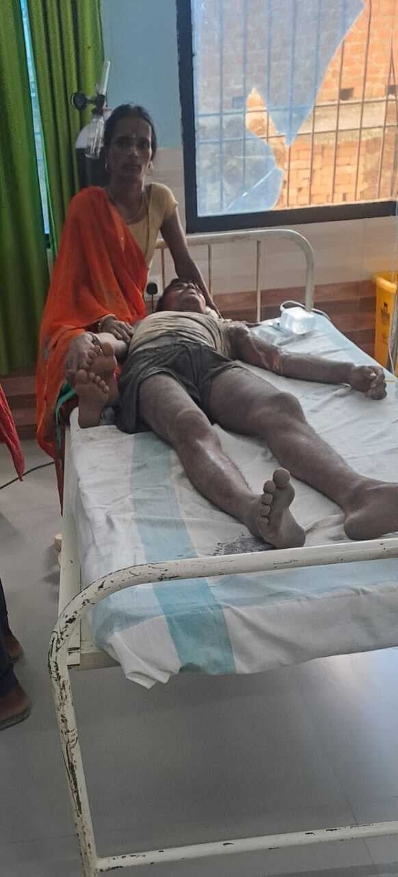 खेत में करेंट लगने से बेटे की मौत बचाने गये पिता सहित दो झुलसे