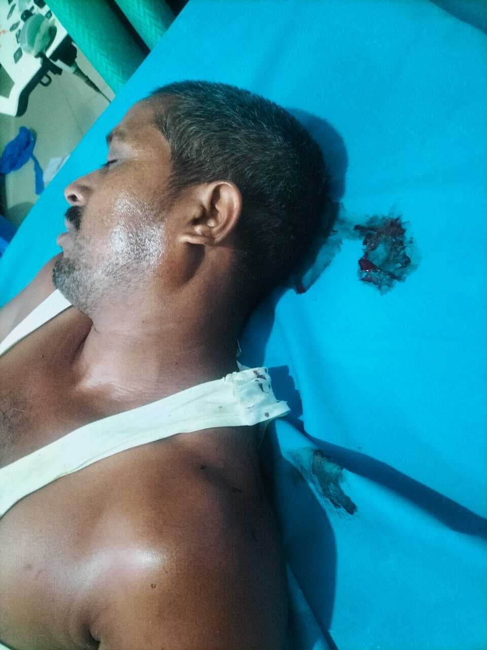 Deoghar News : जमीन विवाद में हिंसक झड़प, तलवार-फरसा से हमला, एक दर्जन लोग घायल