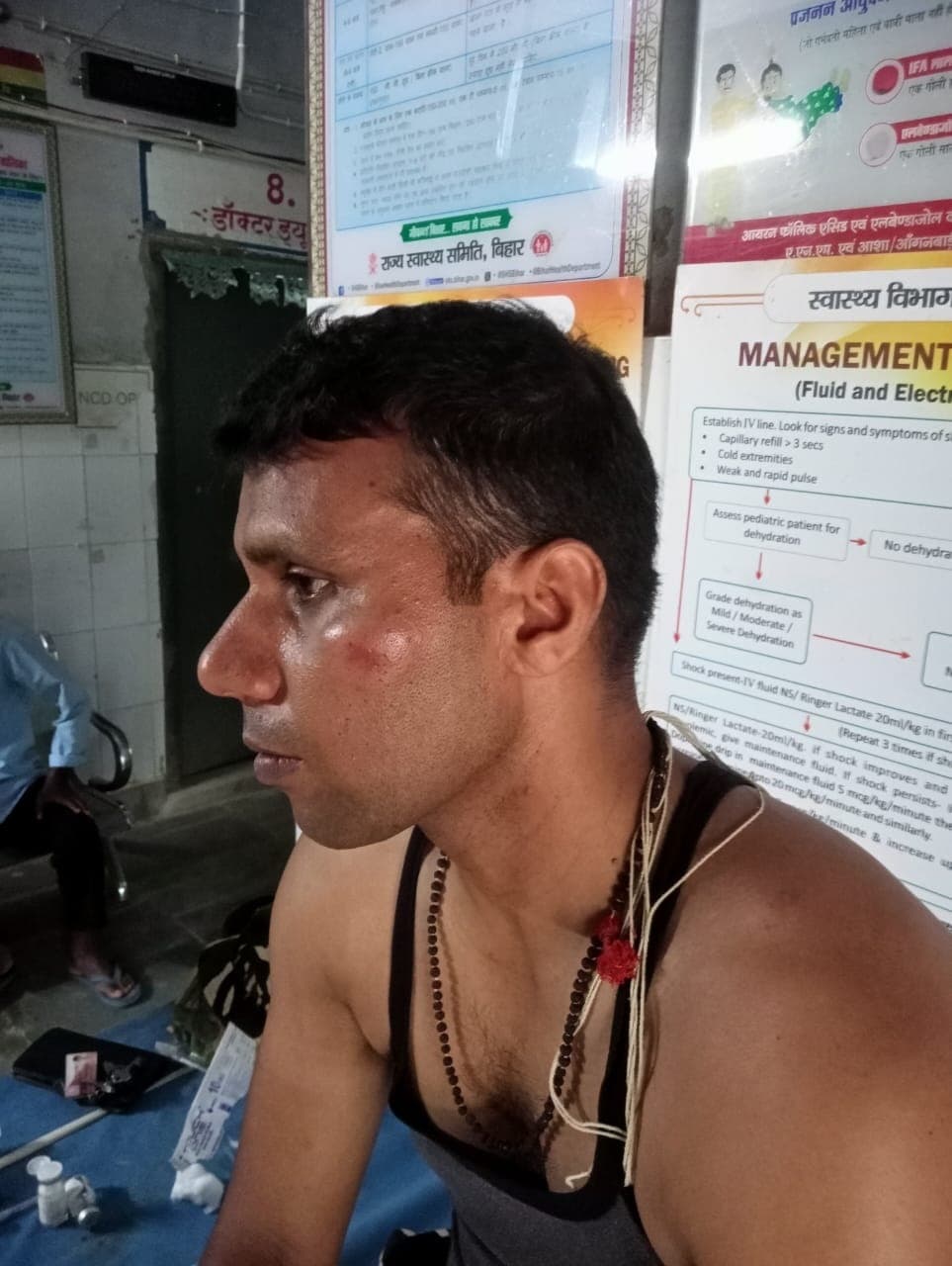 Motihari: बनकटवा अगरवा बॉर्डर के एसएसबी जवानों पर हमला, चार जवान घायल