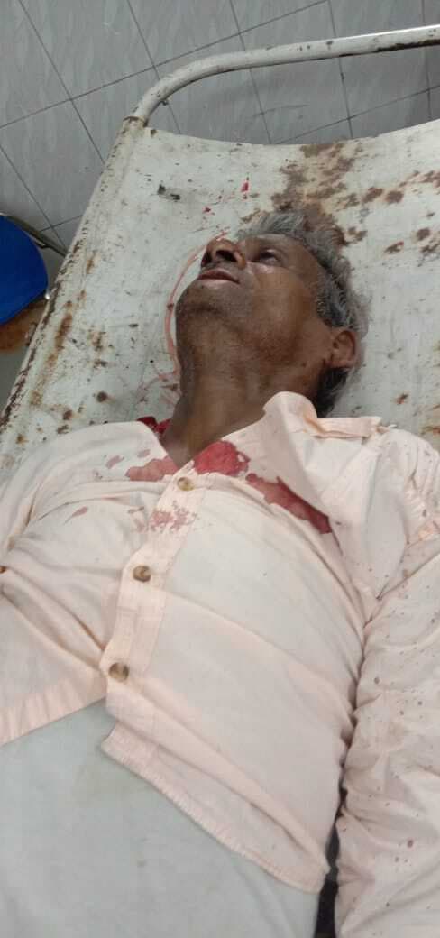 Dhanbad News: सिंदरी में ऑटो के धक्के से बुजुर्ग घायल, रिम्स रेफर