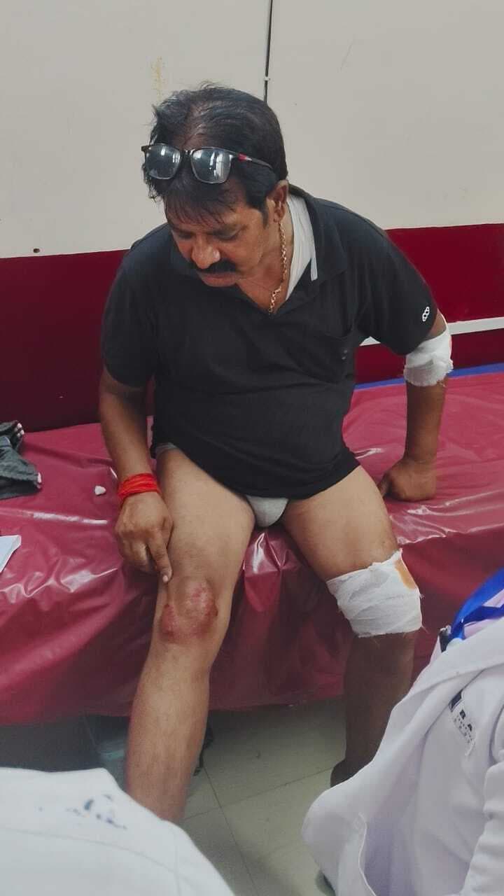 कुत्ते से टकराकर गिरी बाइक, पूर्व पैक्स अध्यक्ष घायल