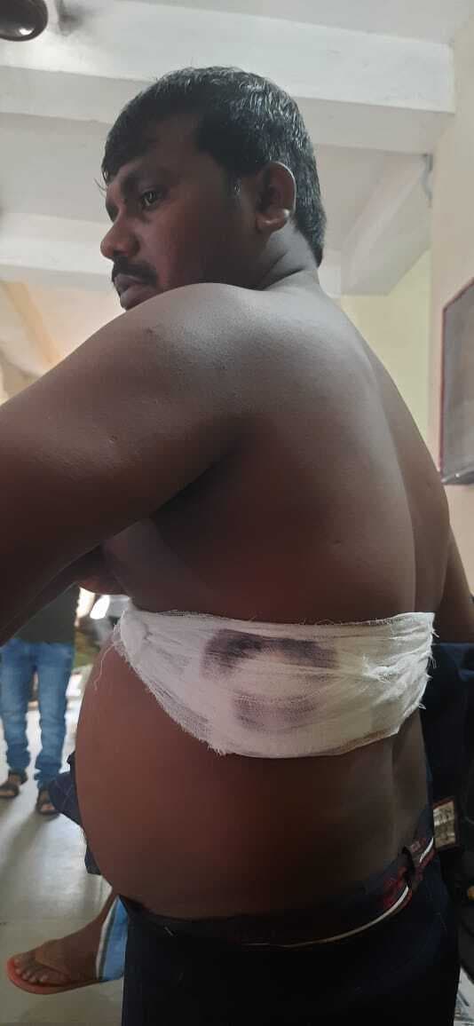 Bokaro News : भाई ने भाई के पेट में मारा चाकू