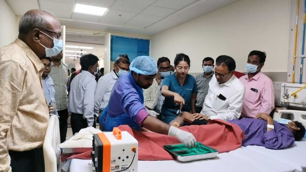Jamshedpur news. एमजीएम अस्पताल में एक माह में चार से पांच लोगों की होती है प्लास्टिक सर्जरी