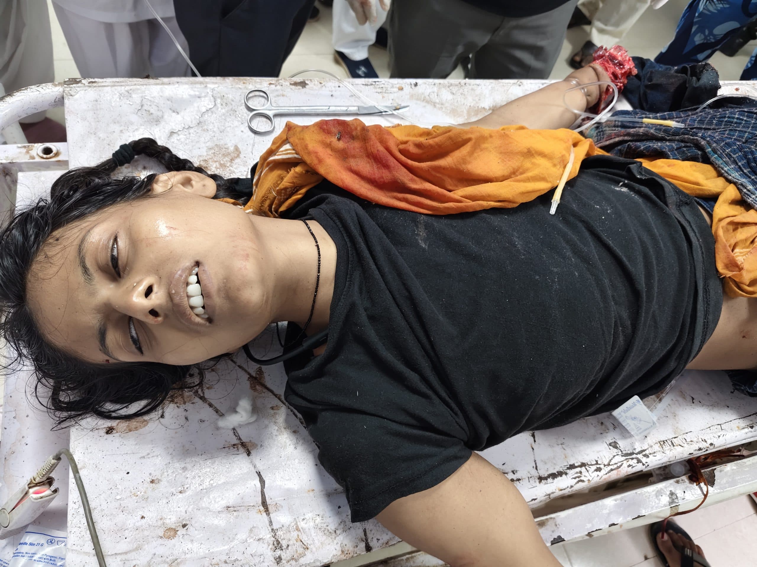 ट्रेन पर चढ़ने के दौरान छात्रा गिरकर घायल, रेफर