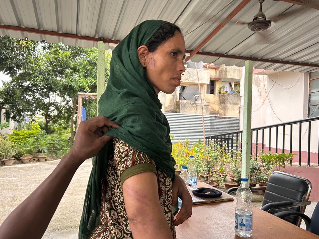 भैंसूर ने छोटे भाई की पत्नी के साथ की मारपीट