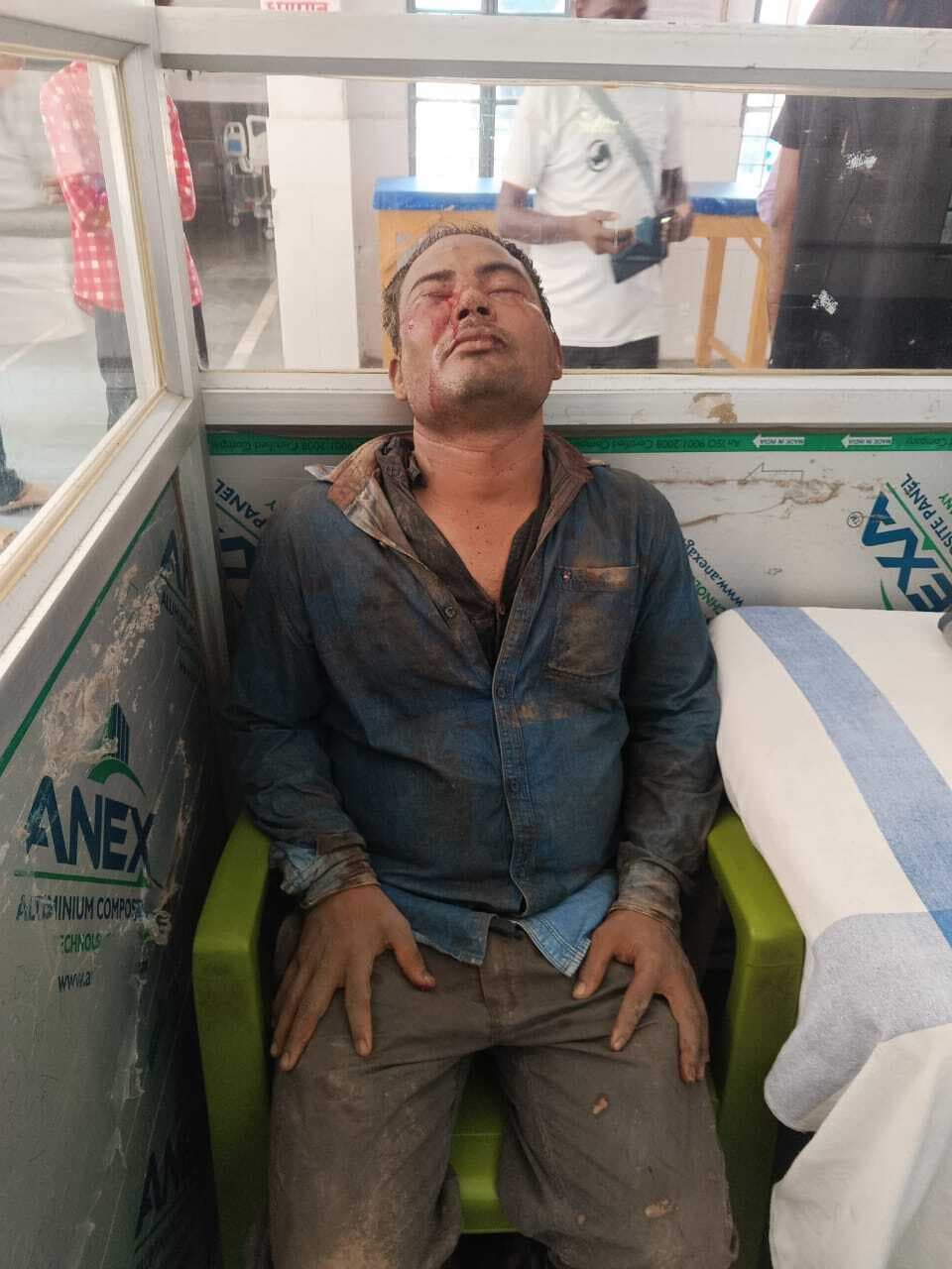 साली से हुई छेड़खानी का विवाद सुलझाने गये जीजा को चाकू मार किया घायल