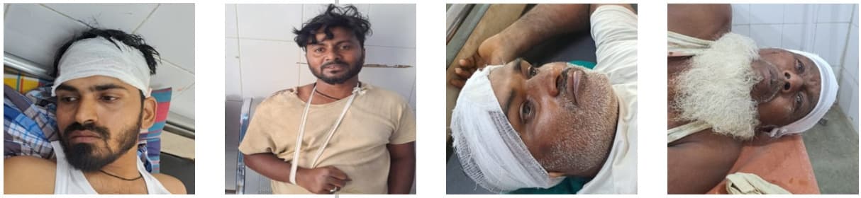 Giridih News: दो पक्षों में खूनी संघर्ष, 10 घायल, दो रेफर