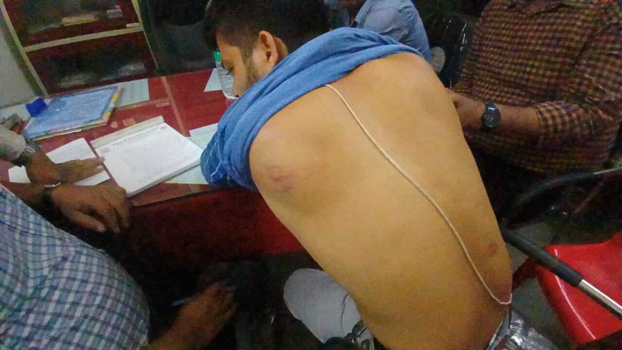 Dhanbad News : बैग नहीं लाने पर दंडित किया, तो तीन छात्रों ने शिक्षक की कर दी पिटाई