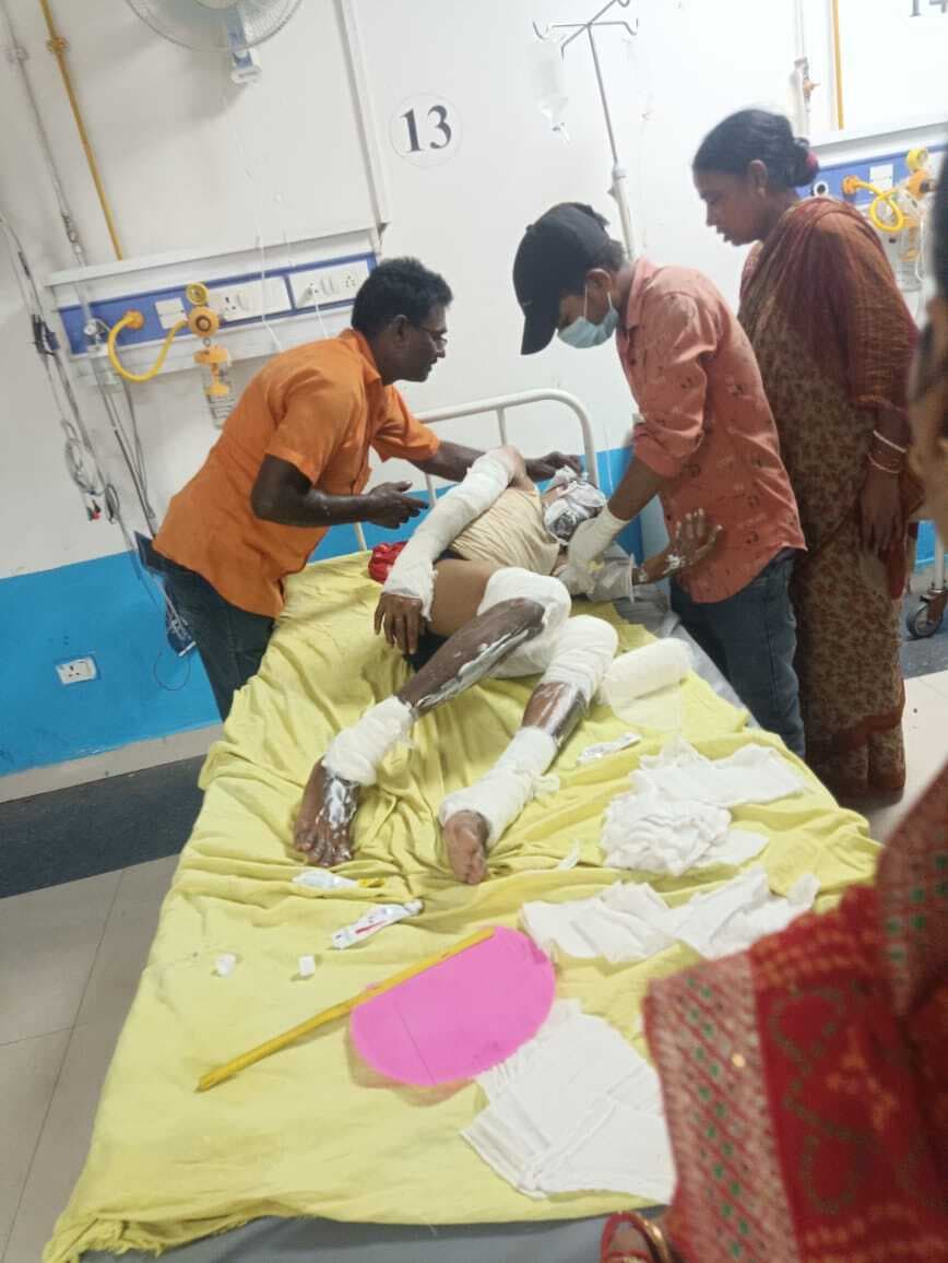 गैस सिलिंडर में लगी आग, युवक झुलसा