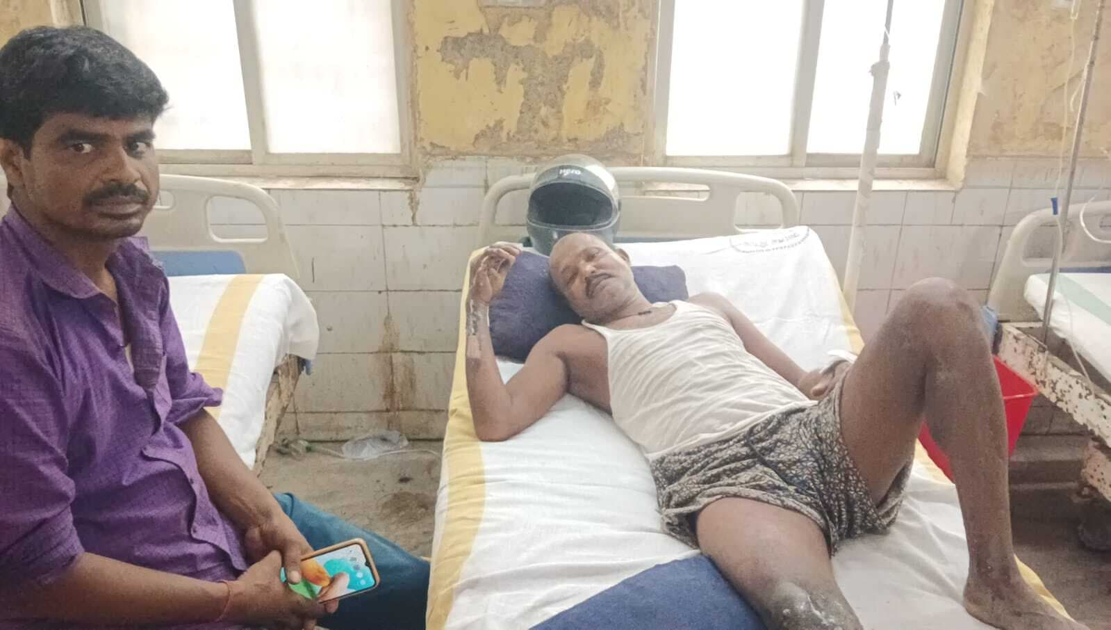हाइ टेंशन तार की चपेट में आने से मजदूर झुलसा, अस्पताल में भर्ती