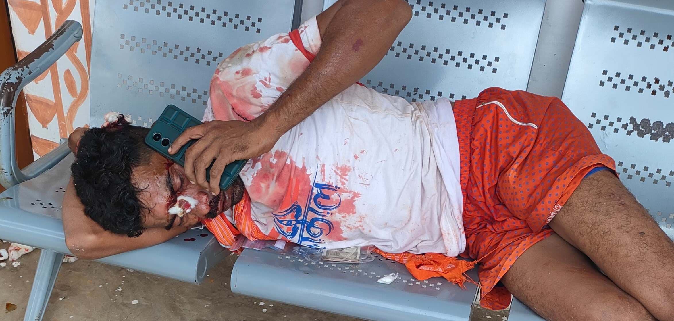 दो बाइकों की टक्कर में तीन लोग घायल