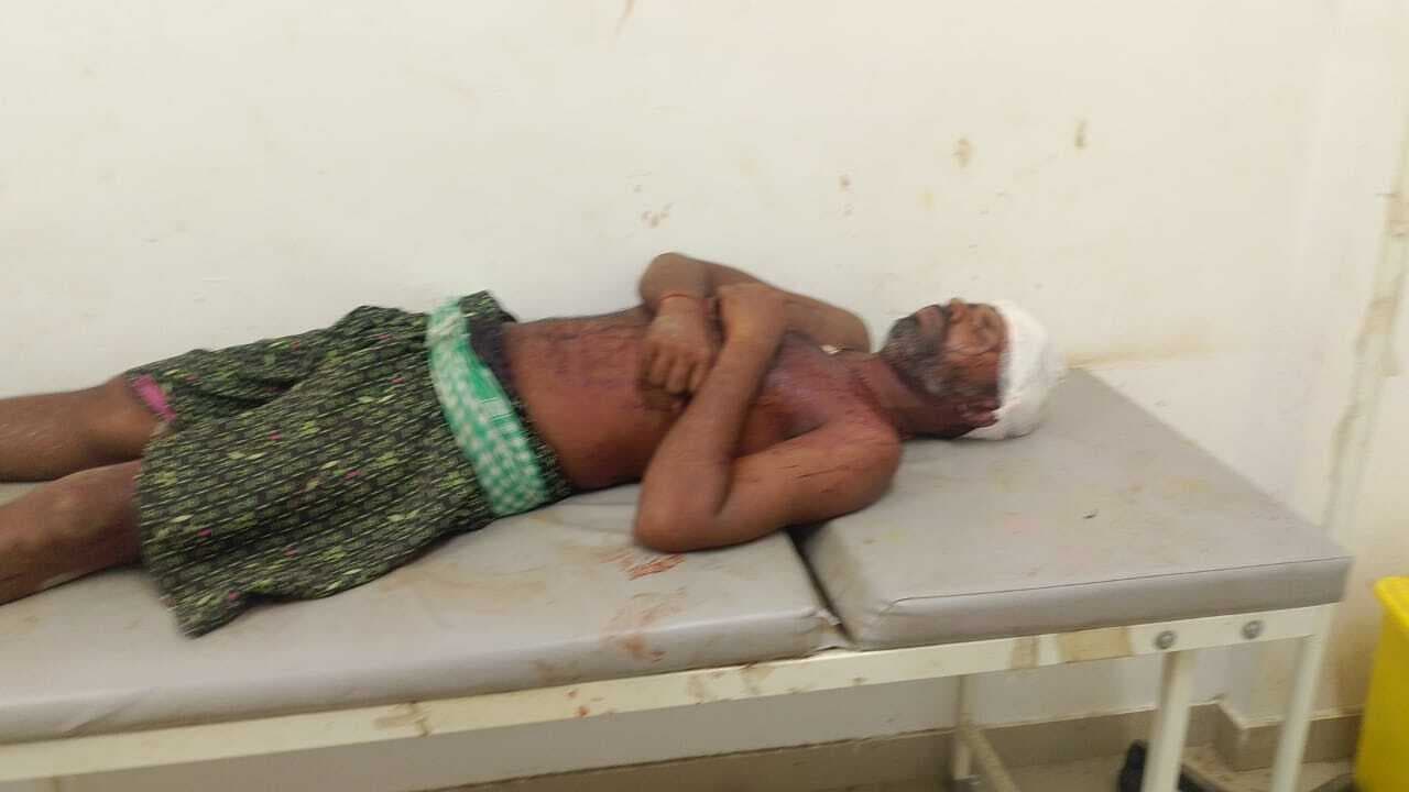 जमीन विवाद में मारपीट, एक जख्मी