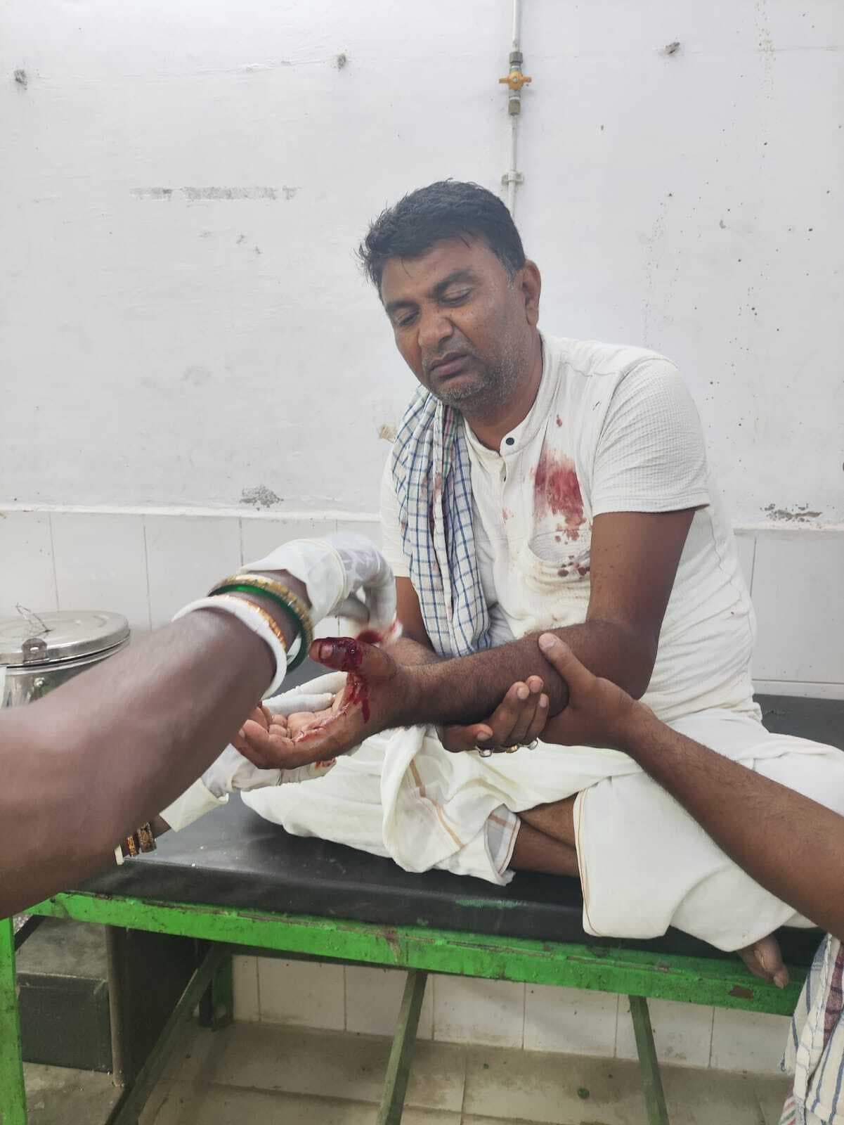 पंचायत समिति सदस्य पर जानलेवा हमला, हमलावर फरार