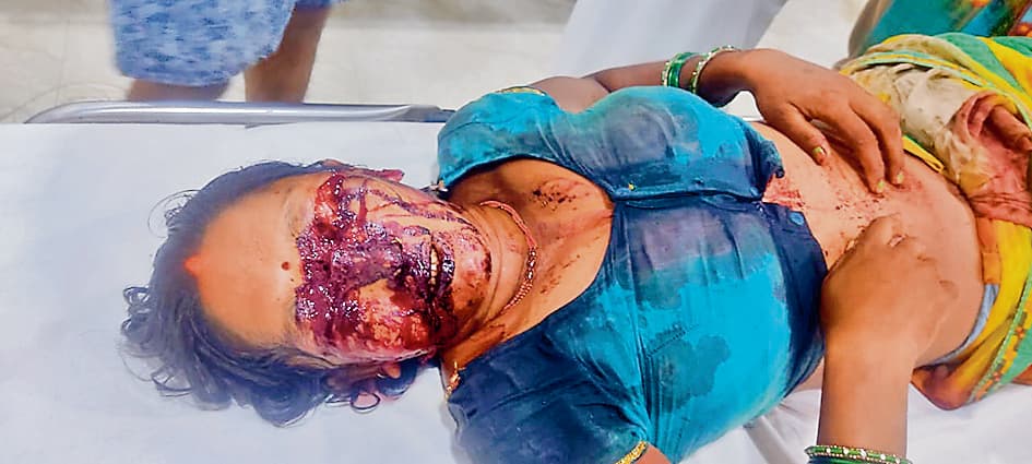 Gaya News : सनकी ससुर ने बहू पर चपड़े से हमला कर दोनों आंखें व नाक काटी