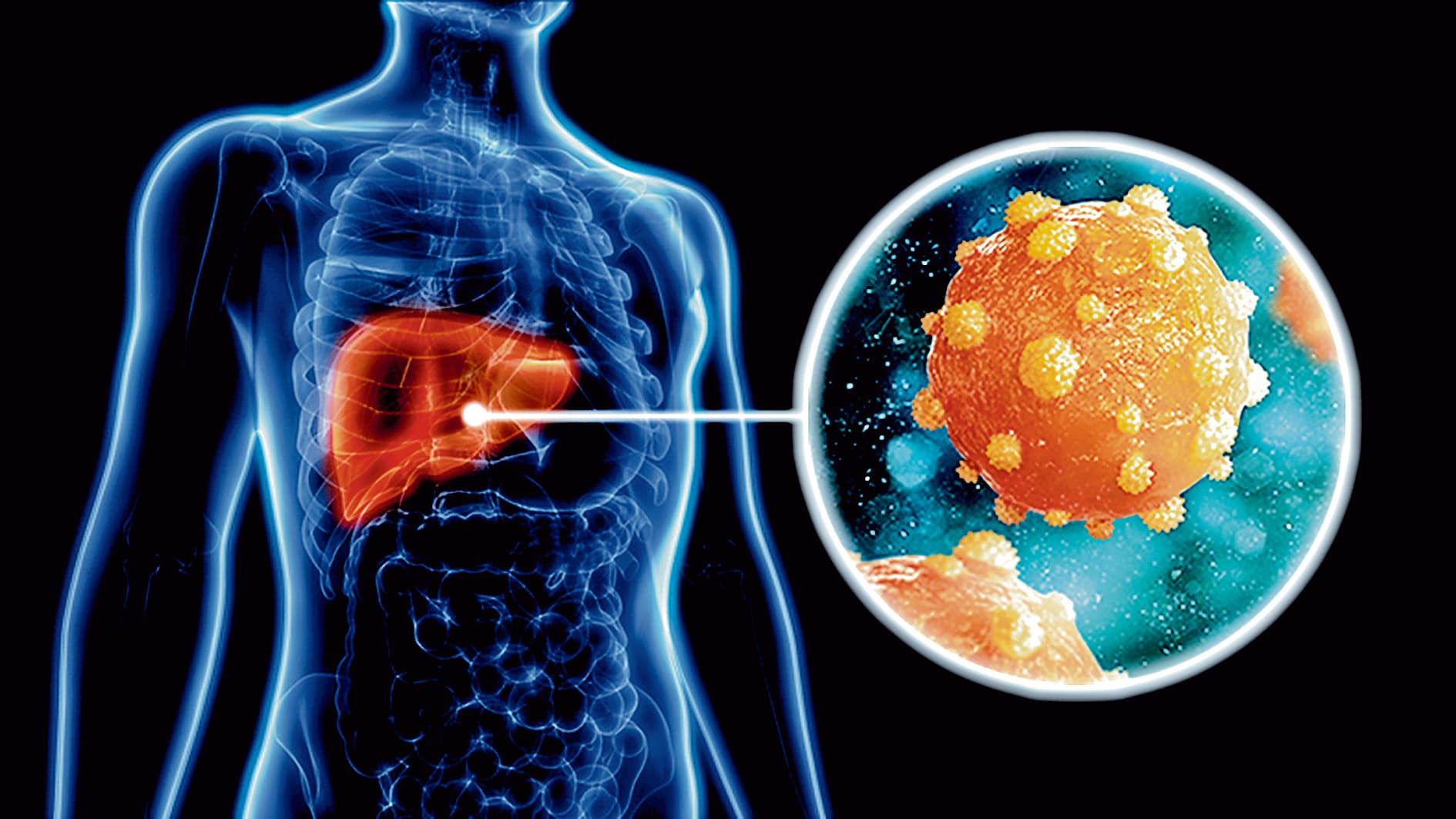 हेपेटाइटिस बी से निबटने में जुटी सरकार, टीकाकरण पर जोर