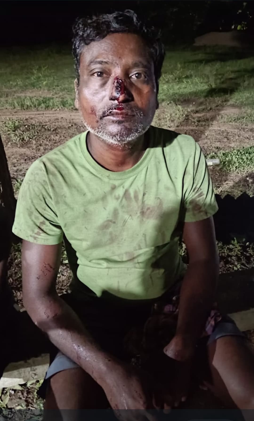 बालू उठाव का विरोध करने पर मारपीट में एक घायल