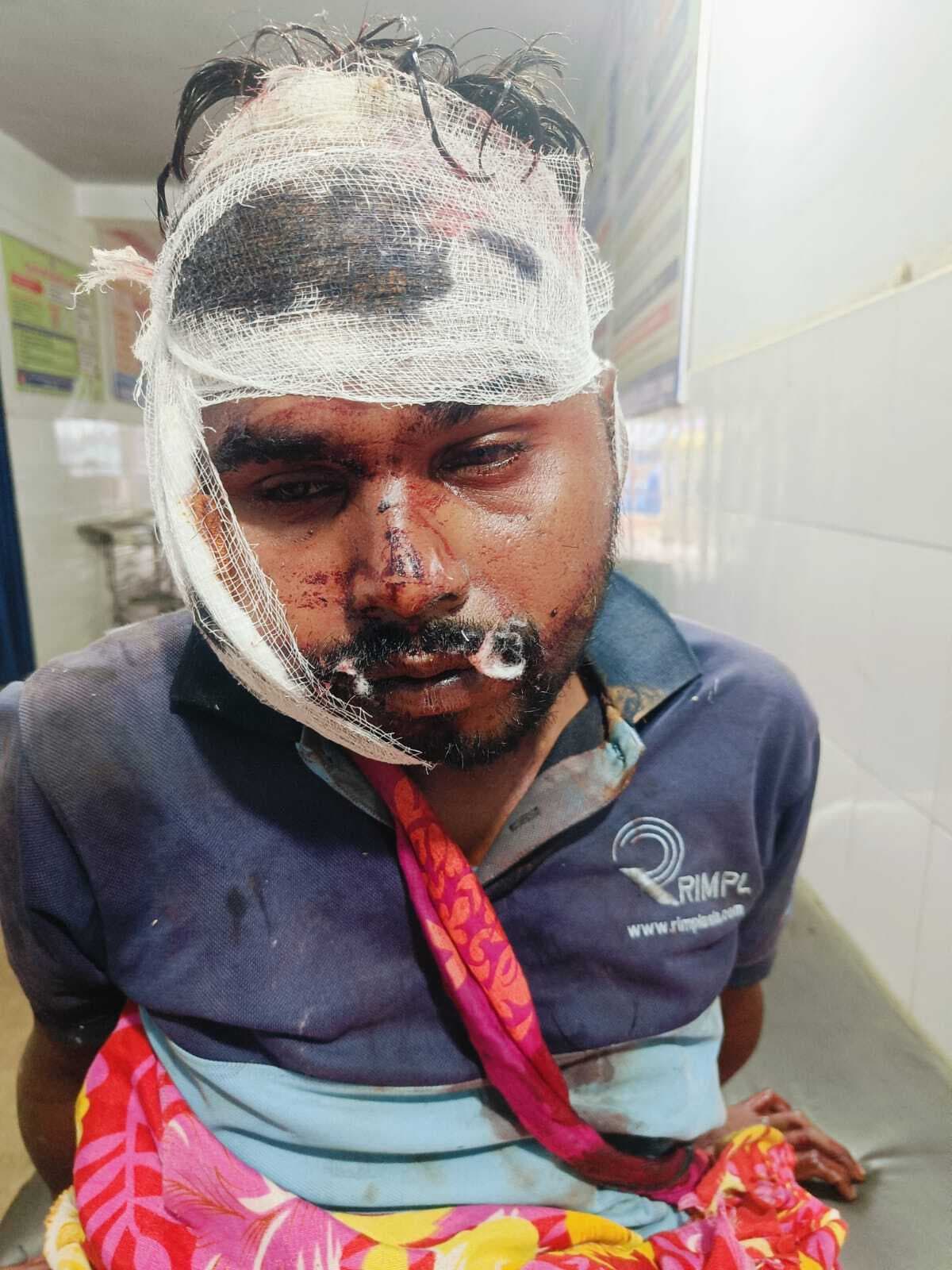 जानलेवा हमले में तीन व्यक्ति घायल, भर्ती