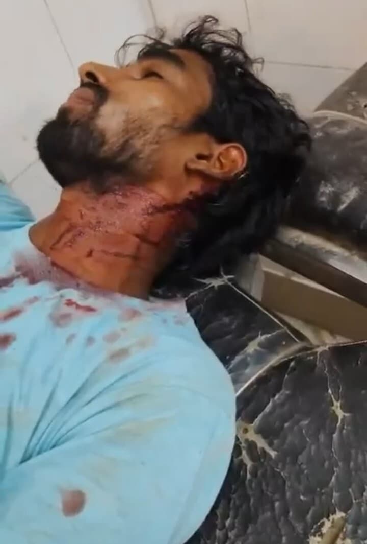 मारपीट में कई घायल, दो दर्जन पर मामला दर्ज