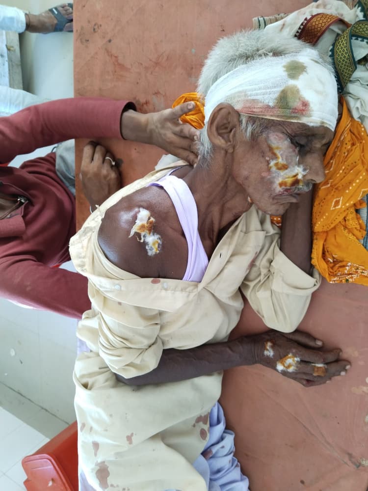 सड़क दुर्घटना में बाइक सवार पिता पुत्र जख्मी