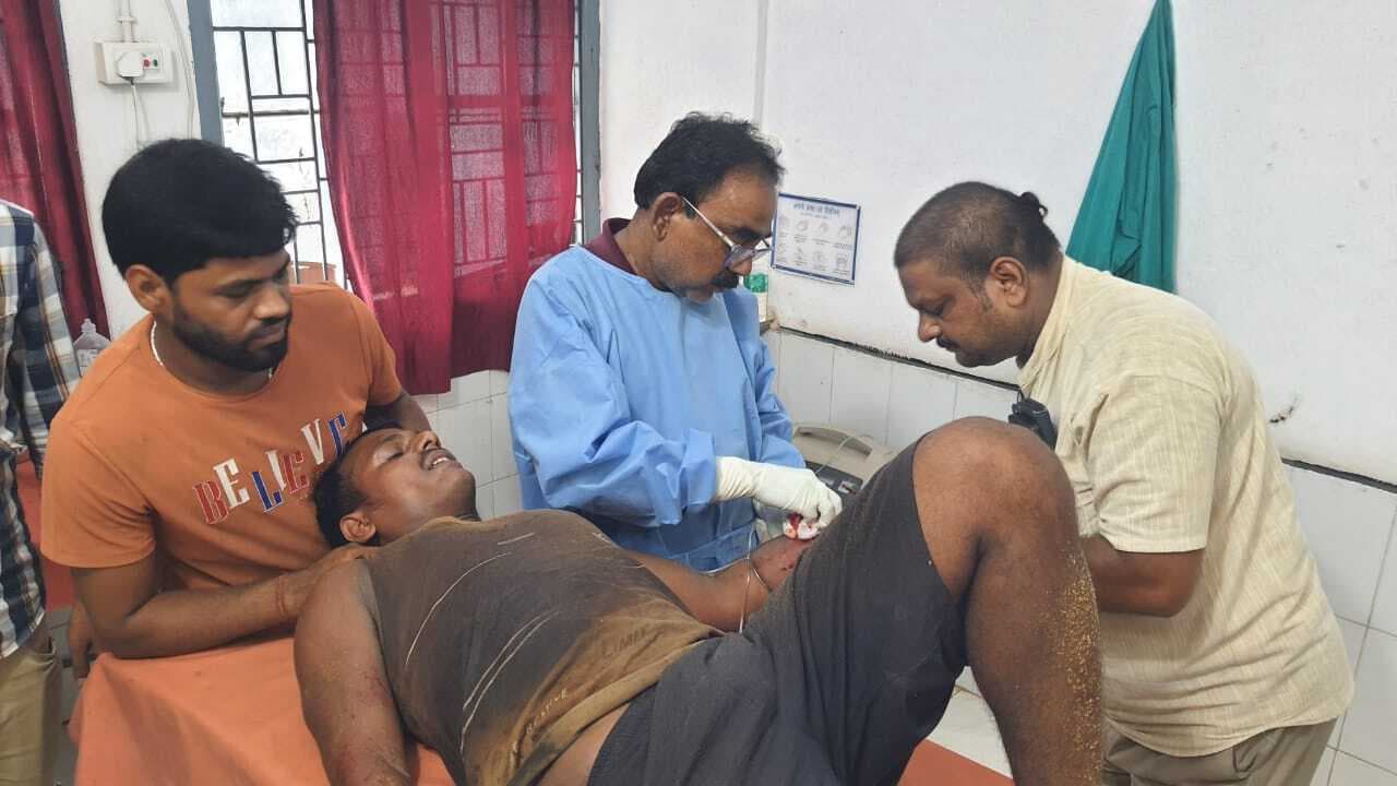 ग्रैंडर मशीन से मिस्त्री की हथेली कटकर हुआ अलग