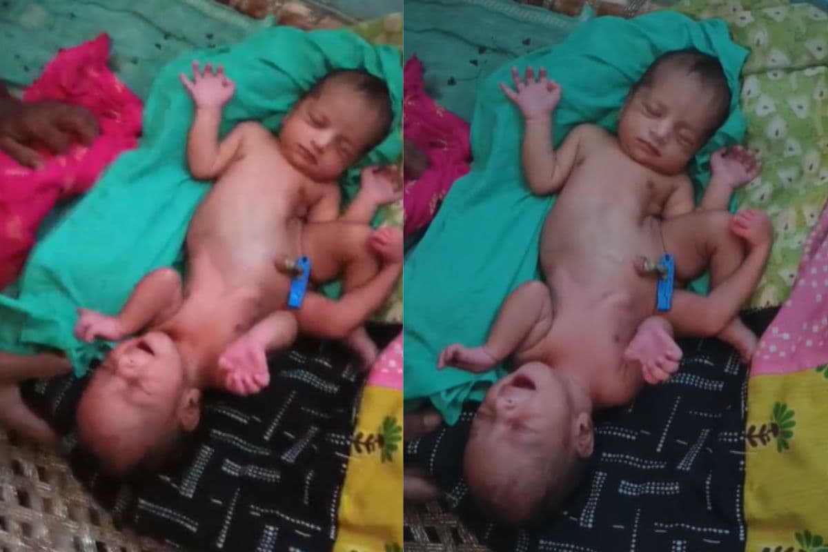 Video: मुजफ्फरपुर में जन्मी अद्भुत बच्ची, दो सिर और चार हाथ देख दंग रह गए लोग