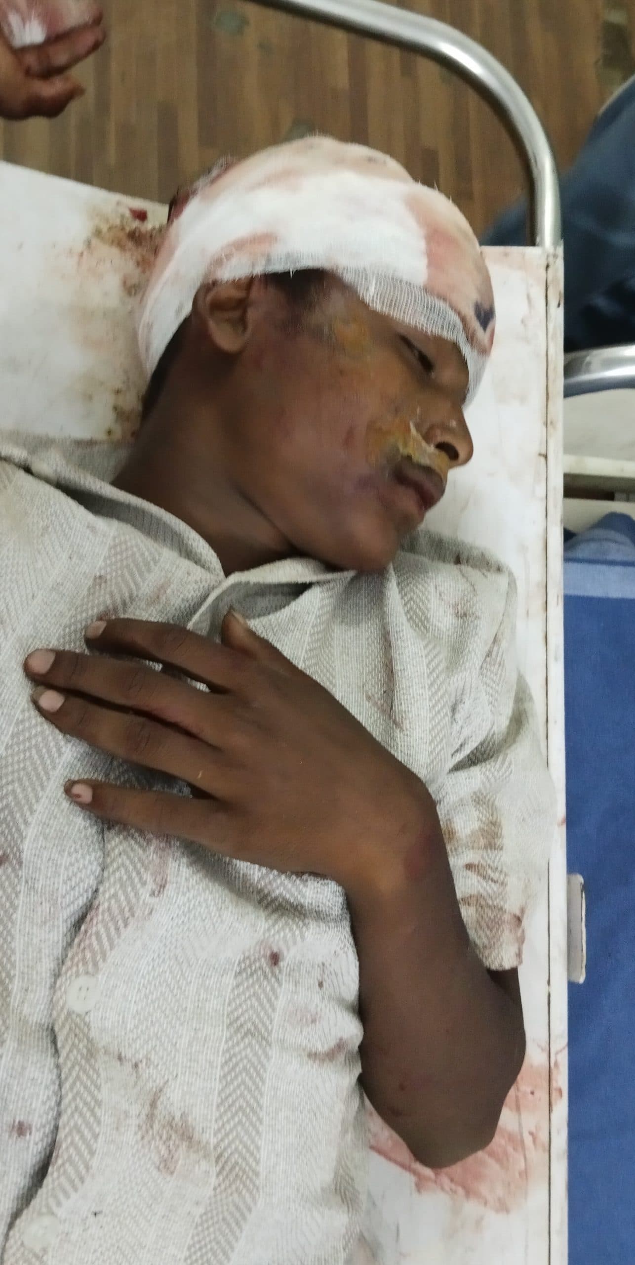 Bokaro News : अज्ञात वाहन की चपेट में आने से बाइक सवार दो युवक घायल