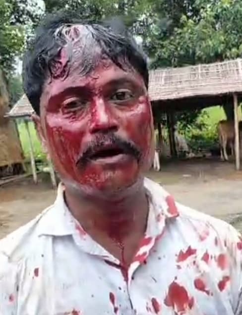 झड़प में पूर्व उपमुखिया समेत आधा दर्जन घायल, दो रेफर